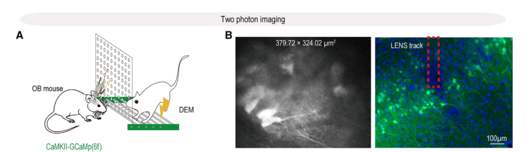 超維景助力東南大學(xué)謝維/李默怡課題組揭示情緒共情的神經(jīng)機制