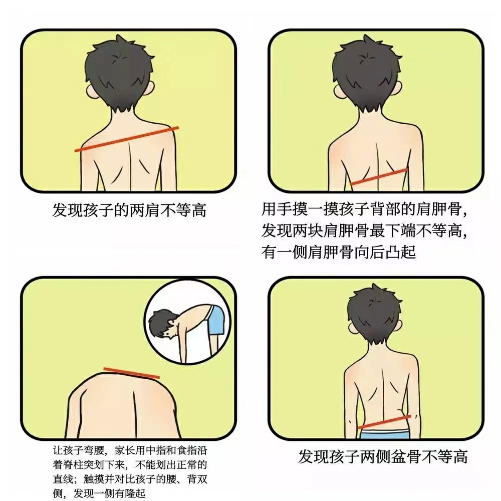 针灸治疗仪什么品牌好脊柱侧弯不用慌，“龙氏正骨”帮您忙~_https://www.jmylbn.com_新闻资讯_第8张