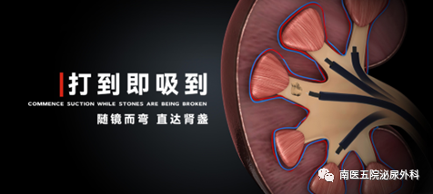 输尿管鞘是什么上尿路结石治疗的又一“神器”---- 头端可弯曲负压输尿管软镜鞘！_https://www.jmylbn.com_新闻资讯_第2张
