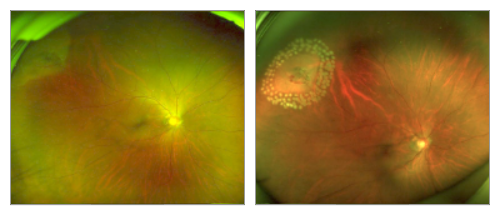 眼底照相有什么用【百闻不如一“健”】全国爱眼日 ｜ 眼底一张照，眼病早知道‍_https://www.jmylbn.com_新闻资讯_第27张