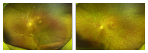 眼底照相有什么用【百闻不如一“健”】全国爱眼日 ｜ 眼底一张照，眼病早知道‍_https://www.jmylbn.com_新闻资讯_第19张