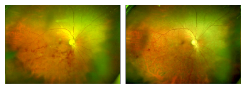 眼底照相有什么用【百闻不如一“健”】全国爱眼日 ｜ 眼底一张照，眼病早知道‍_https://www.jmylbn.com_新闻资讯_第22张