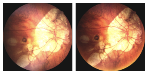 眼底照相有什么用【百闻不如一“健”】全国爱眼日 ｜ 眼底一张照，眼病早知道‍_https://www.jmylbn.com_新闻资讯_第26张