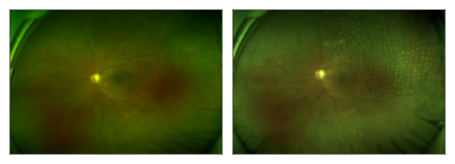 眼底照相有什么用【百闻不如一“健”】全国爱眼日 ｜ 眼底一张照，眼病早知道‍_https://www.jmylbn.com_新闻资讯_第23张