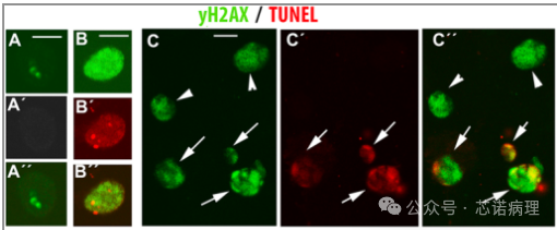 yH2AX / TUNEL