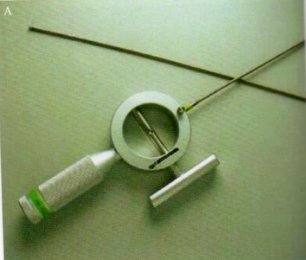 取石网篮为什么这么贵【ERCP护理】内镜下机械碎石取石术护理配合_https://www.jmylbn.com_新闻资讯_第19张