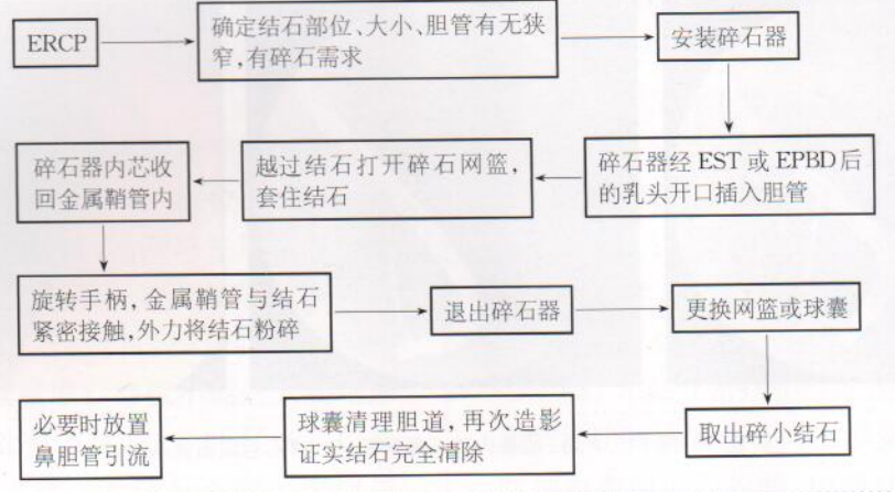 取石网篮为什么这么贵【ERCP护理】内镜下机械碎石取石术护理配合_https://www.jmylbn.com_新闻资讯_第9张