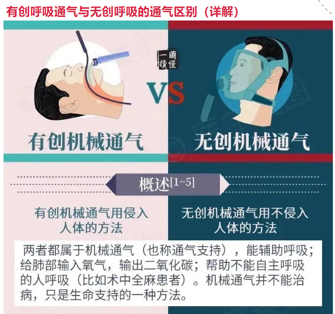 哪些科室用呼吸机医学科普丨ICU救命神器“呼吸机”你了解多少？_https://www.jmylbn.com_新闻资讯_第15张