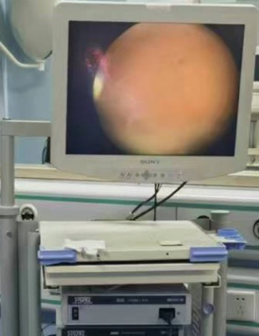 宫腔镜器械怎么安装宫腹腔镜的基本构成及工作原理_https://www.jmylbn.com_新闻资讯_第5张