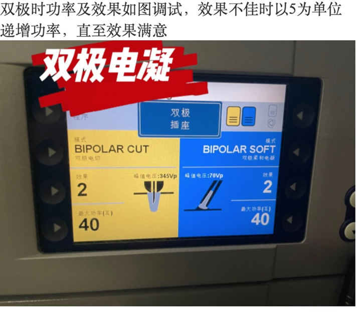 宫腔镜器械怎么安装宫腹腔镜的基本构成及工作原理_https://www.jmylbn.com_新闻资讯_第26张