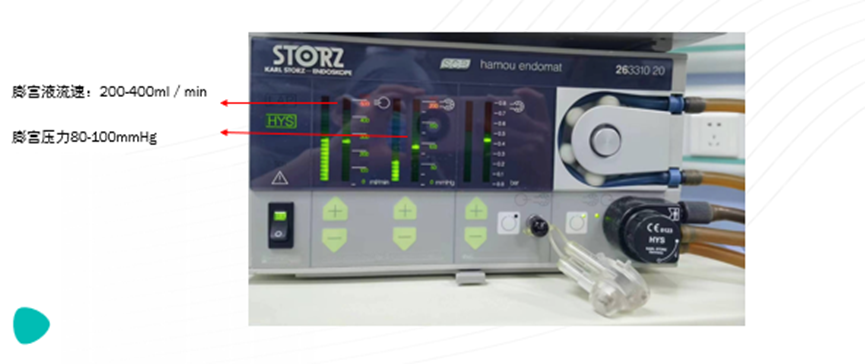 宫腔镜器械怎么安装宫腹腔镜的基本构成及工作原理_https://www.jmylbn.com_新闻资讯_第8张