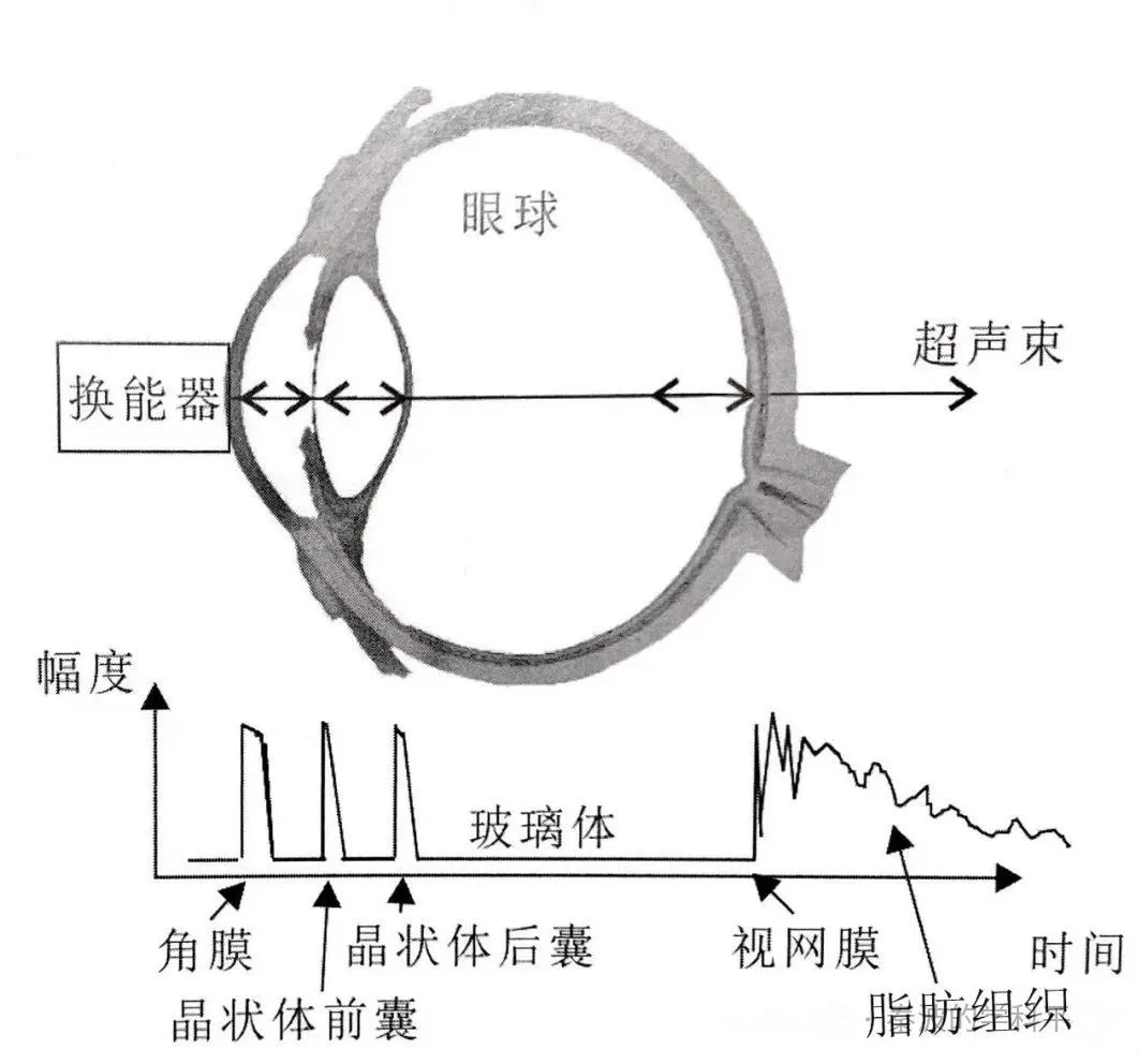 眼科ab超怎么操作了解眼科检查——A型超声_https://www.jmylbn.com_新闻资讯_第6张