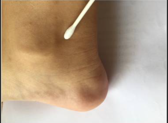 感觉阀值测量怎么测感觉功能评定概述_https://www.jmylbn.com_新闻资讯_第2张