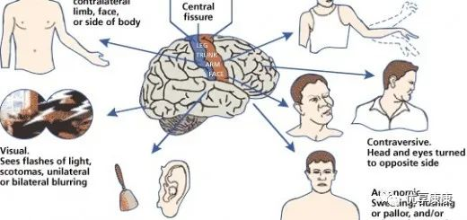 感觉阀值测量怎么测感觉功能评定概述_https://www.jmylbn.com_新闻资讯_第1张