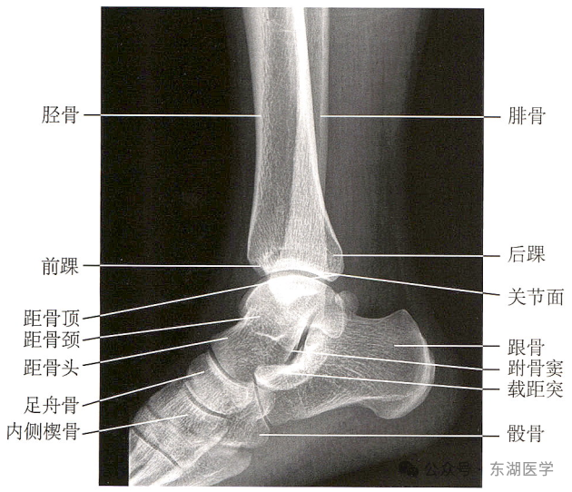踝、足骨骼影像解剖，收藏版