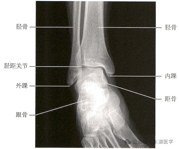 踝、足骨骼影像解剖，收藏版