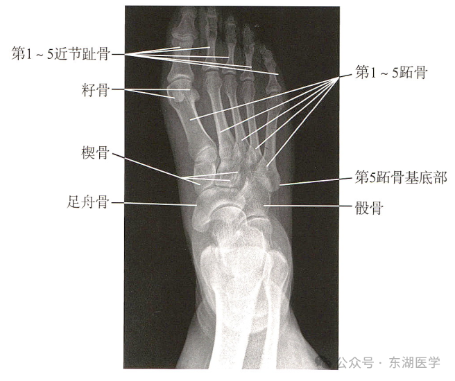 踝、足骨骼影像解剖，收藏版