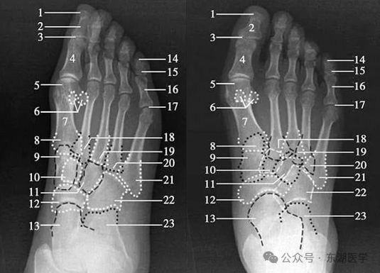 踝、足骨骼影像解剖，收藏版