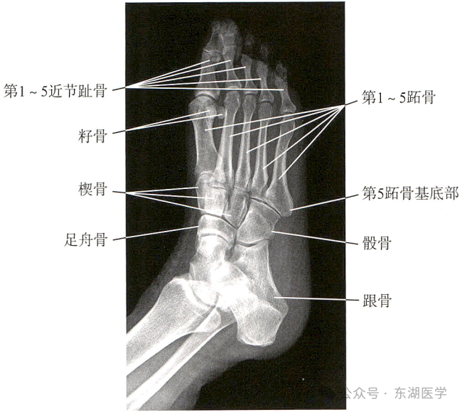 踝、足骨骼影像解剖，收藏版