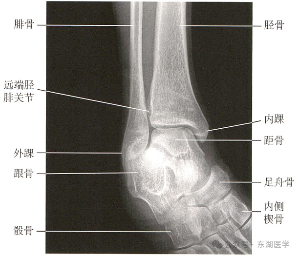 踝、足骨骼影像解剖，收藏版