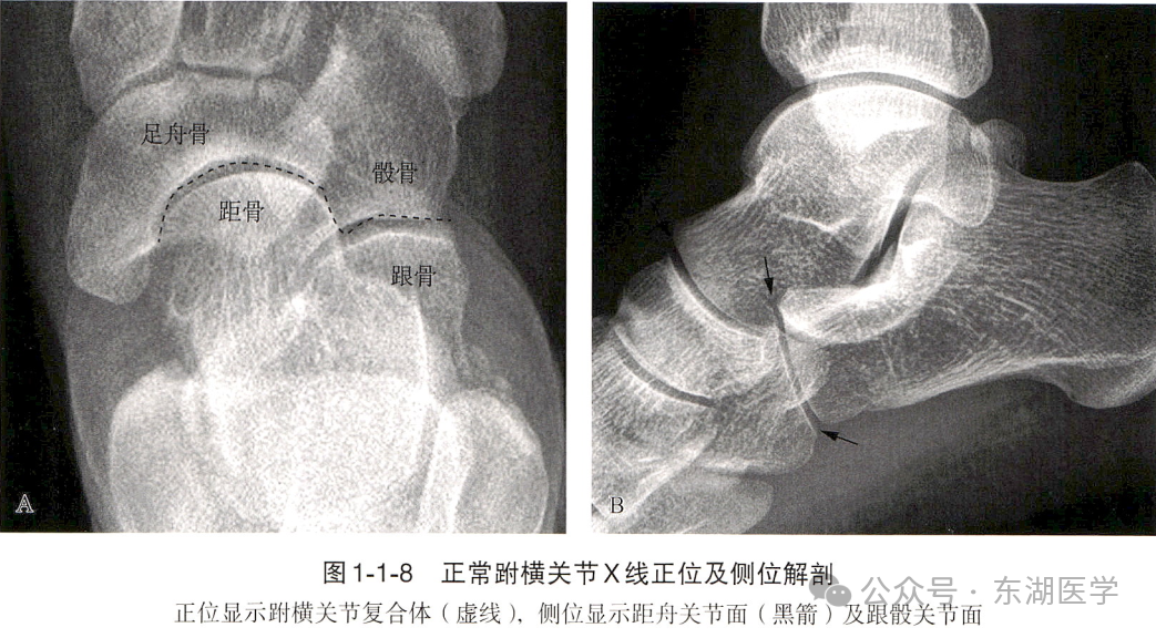 踝、足骨骼影像解剖，收藏版