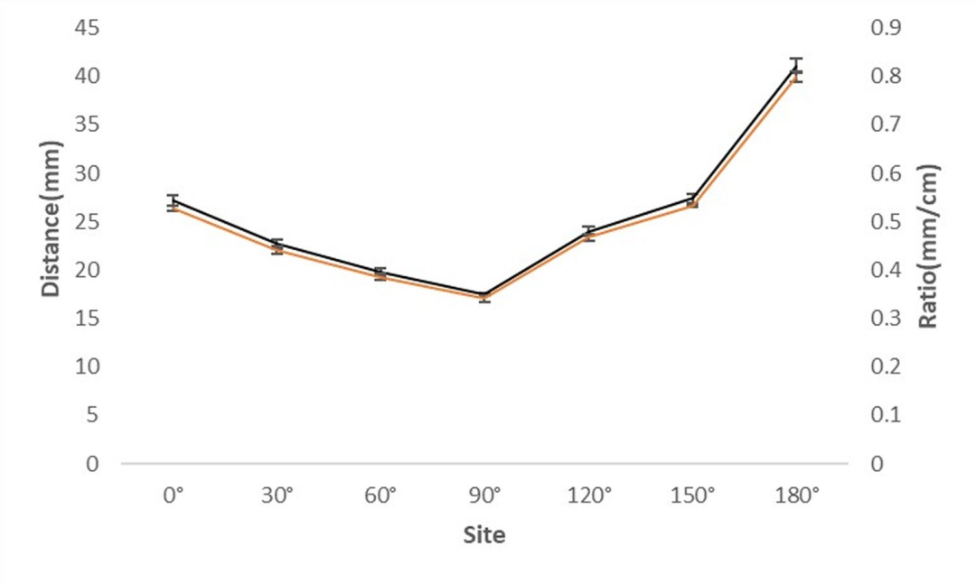DAA全髋置换：关键解剖标志与操作要点