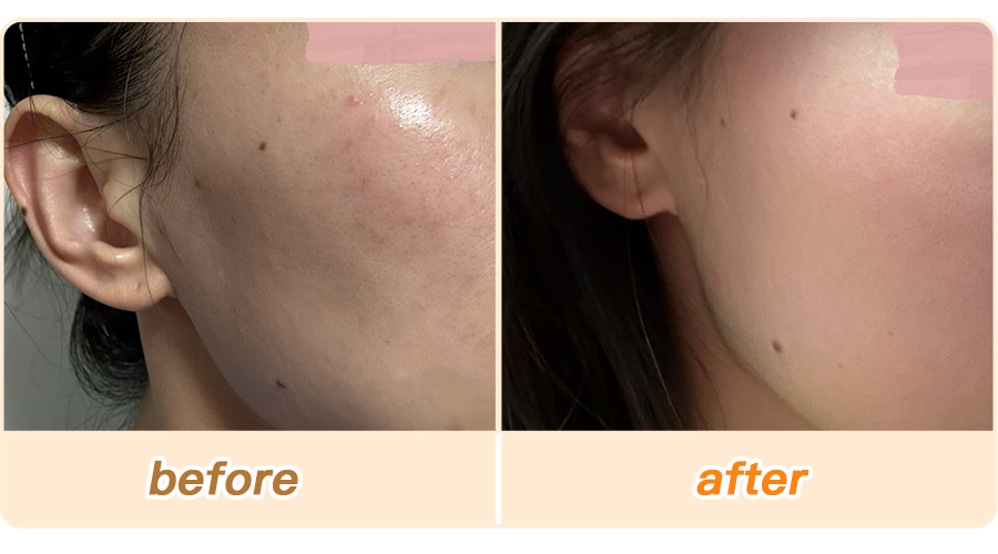 绽媄娅的产品怎么样比买包爽100倍！糕妈的“医美平替”太绝了！素颜年轻5岁，连老公都夸认不出_https://www.jmylbn.com_新闻资讯_第32张