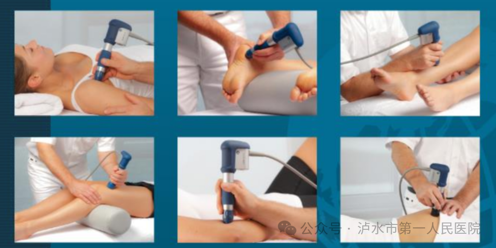 冲击波治疗效果怎么样【疼痛终结者】冲击波＋超声波疗法让止痛效果加倍_https://www.jmylbn.com_新闻资讯_第5张