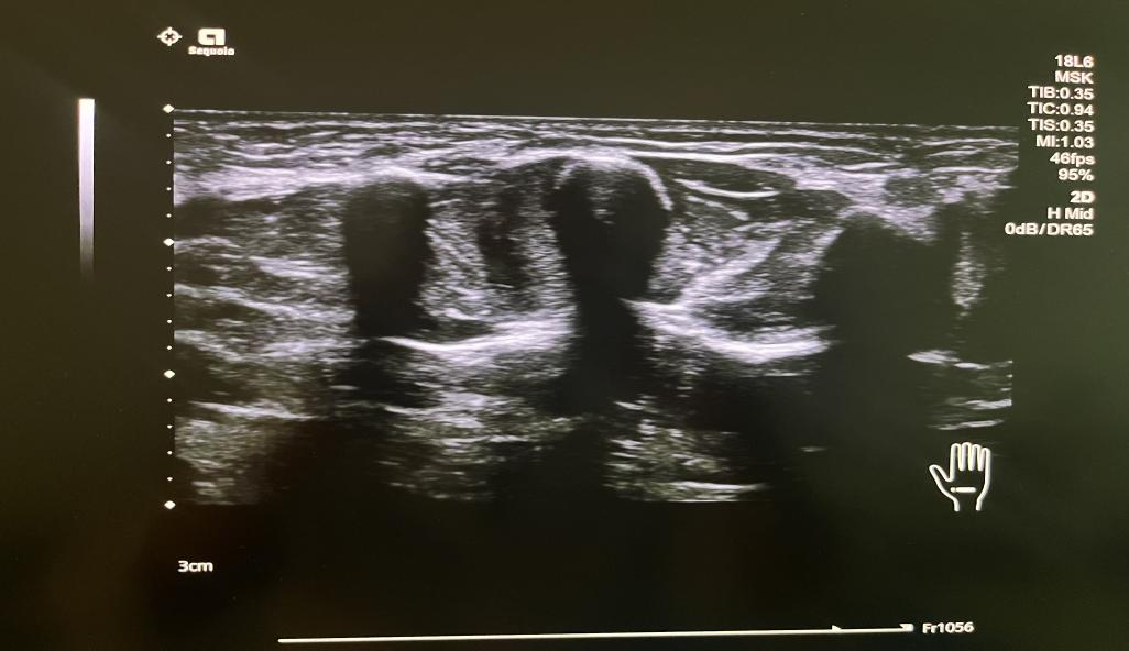 耦合剂怎么加热这个冬季有点暖！来自冕宁县人民医院超声科的暖心服务——耦合剂恒温加热_https://www.jmylbn.com_新闻资讯_第12张