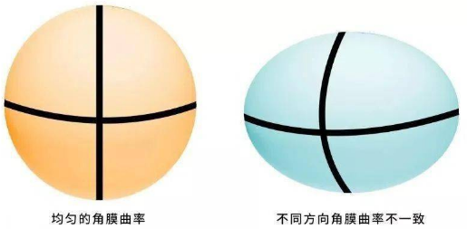 眼科a超单数据怎么看孩子近视的秘密代码，都在一张图中_https://www.jmylbn.com_新闻资讯_第12张