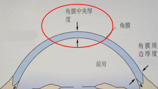 眼科a超单数据怎么看孩子近视的秘密代码，都在一张图中_https://www.jmylbn.com_新闻资讯_第20张