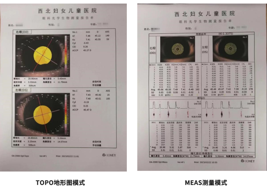 眼科a超单数据怎么看孩子近视的秘密代码，都在一张图中_https://www.jmylbn.com_新闻资讯_第1张