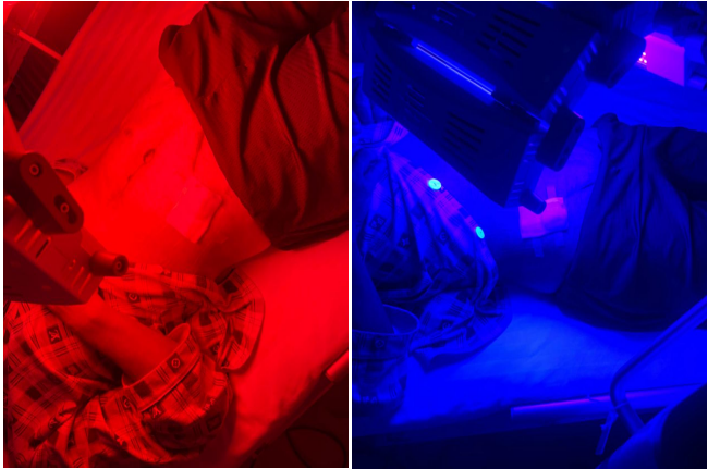 红蓝光治疗仪怎么样你，相信光吗？红蓝光治疗点亮伤口愈合之路_https://www.jmylbn.com_新闻资讯_第2张