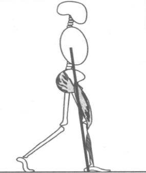 步态分析上曲线怎么解读【门诊服务】要运动不要受伤！步态分析给你指导_https://www.jmylbn.com_新闻资讯_第5张