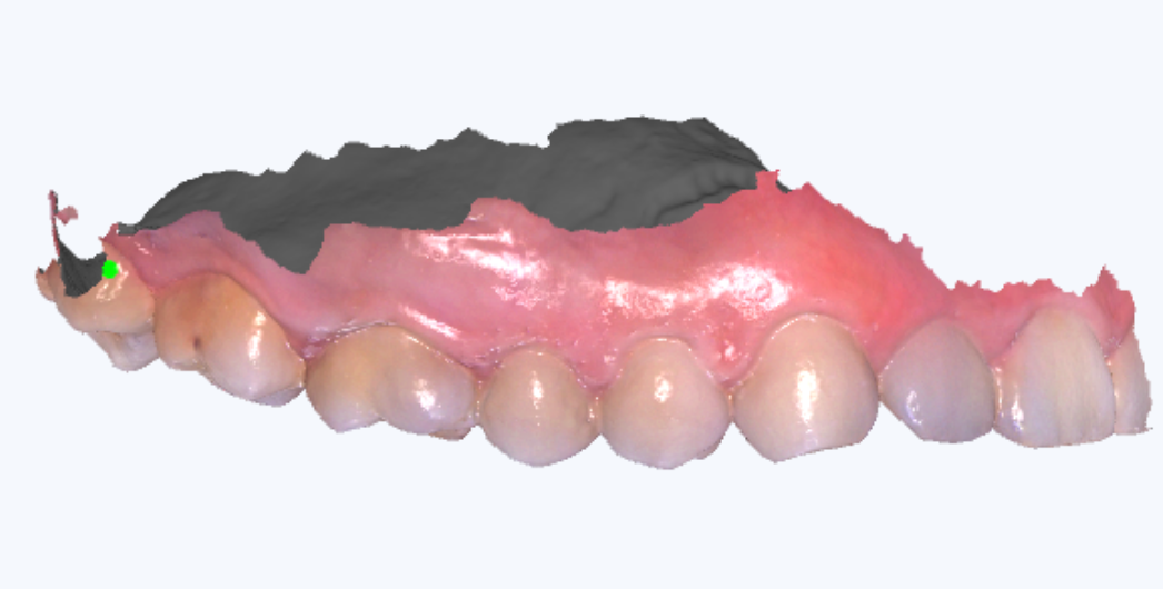 数字牙片机怎么用【新技术】口腔三维数字化扫描术_https://www.jmylbn.com_新闻资讯_第3张
