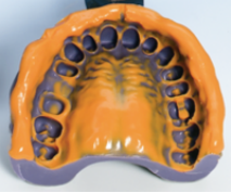 数字牙片机怎么用【新技术】口腔三维数字化扫描术_https://www.jmylbn.com_新闻资讯_第1张