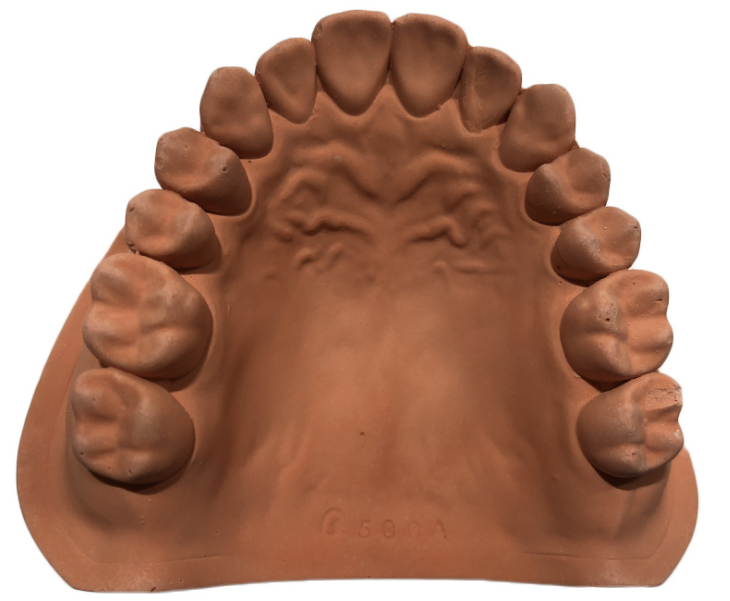 数字牙片机怎么用【新技术】口腔三维数字化扫描术_https://www.jmylbn.com_新闻资讯_第2张