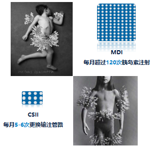 为什么要用泵打针糖尿病患者的“贴身守护神”——胰岛素泵治疗!_https://www.jmylbn.com_新闻资讯_第15张