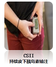 为什么要用泵打针糖尿病患者的“贴身守护神”——胰岛素泵治疗!_https://www.jmylbn.com_新闻资讯_第12张