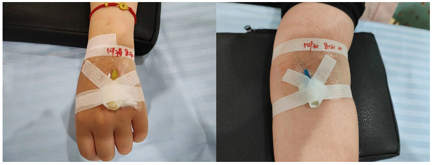 为什么输血不能用小针【护理天地】关于留置针的健康教育_https://www.jmylbn.com_新闻资讯_第6张