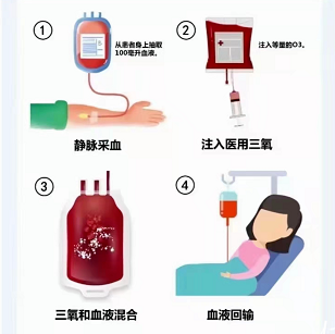 三氧疗法怎么代理市中心医院：带您了解“三氧疗法”_https://www.jmylbn.com_新闻资讯_第4张