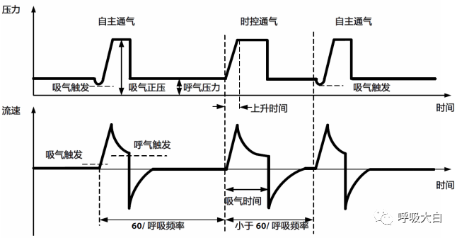 呼吸机的怎么调节全面了解无创通气模式和参数的设置_https://www.jmylbn.com_新闻资讯_第26张