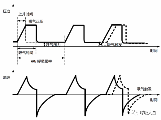 呼吸机的怎么调节全面了解无创通气模式和参数的设置_https://www.jmylbn.com_新闻资讯_第23张
