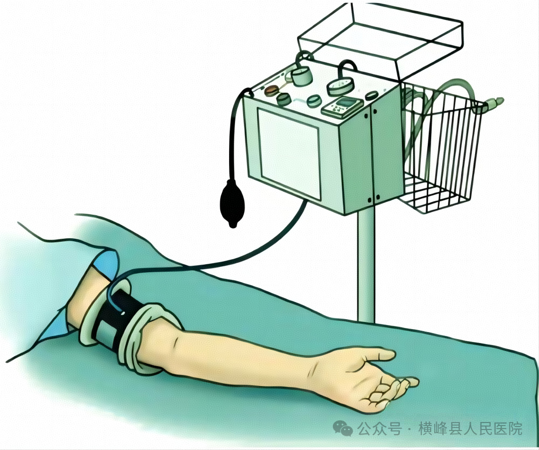 手术怎么止血【健康科普】手术出血怎么办？别担心，我们有止血神器。_https://www.jmylbn.com_新闻资讯_第11张