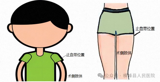 手术怎么止血【健康科普】手术出血怎么办？别担心，我们有止血神器。_https://www.jmylbn.com_新闻资讯_第10张