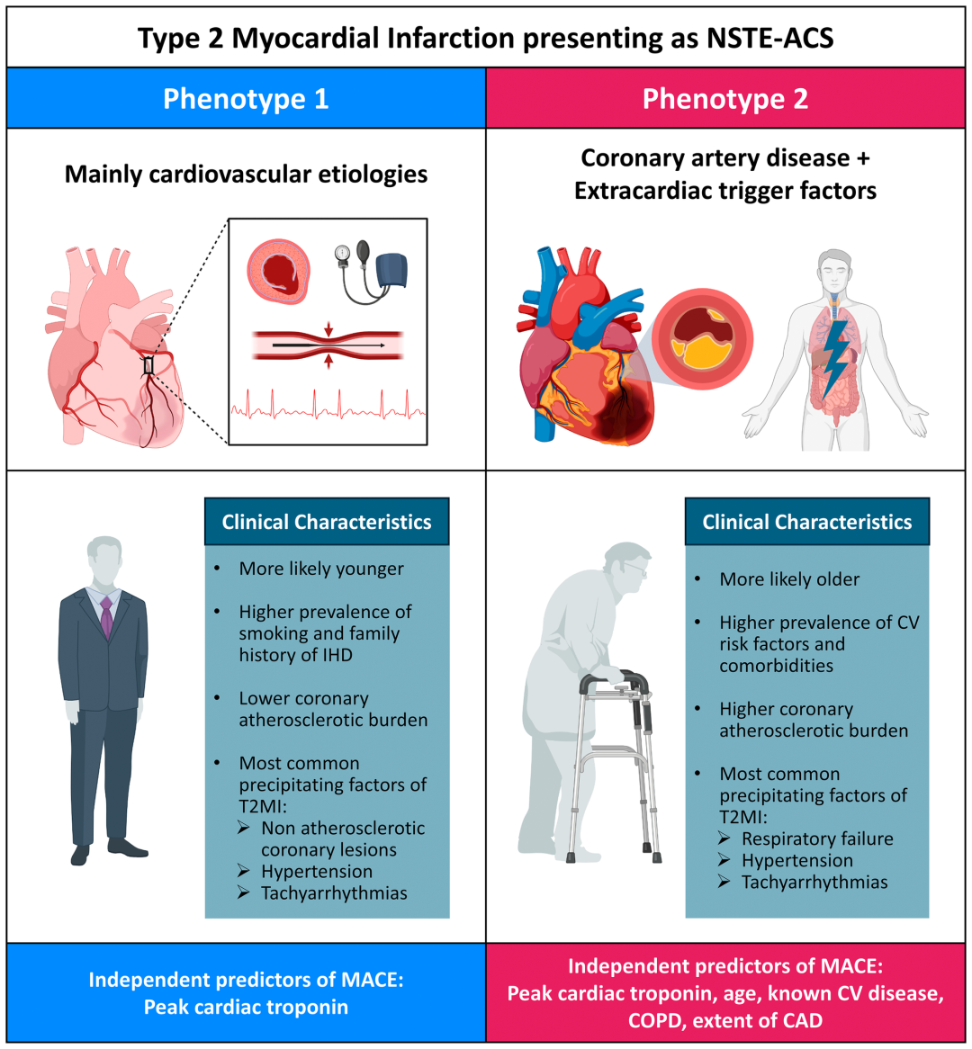 1型心肌梗死和2型心肌梗死的区别