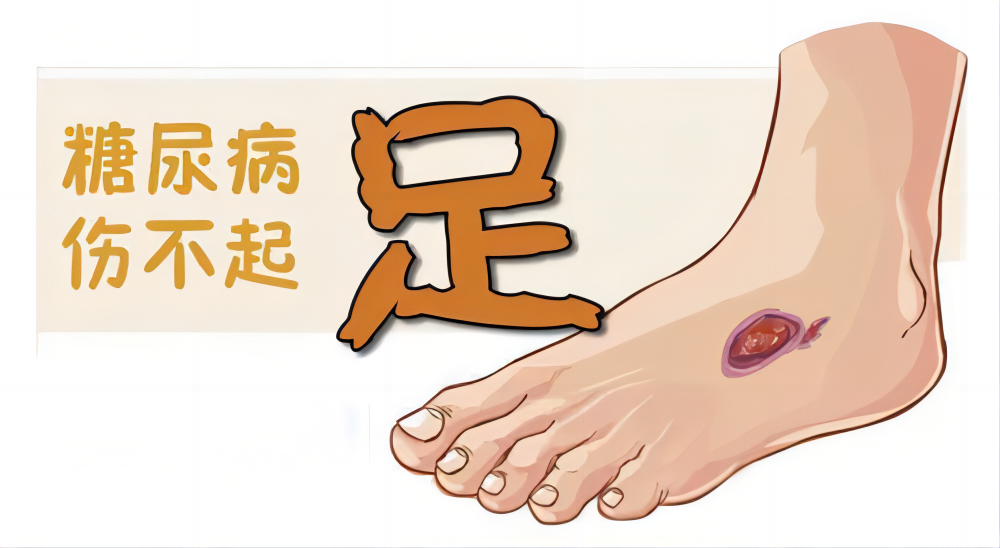 为什么糖尿病不能震动【广大糖友的福音！】糖尿病周围神经病变筛查之震动感觉阈值检测_https://www.jmylbn.com_新闻资讯_第12张