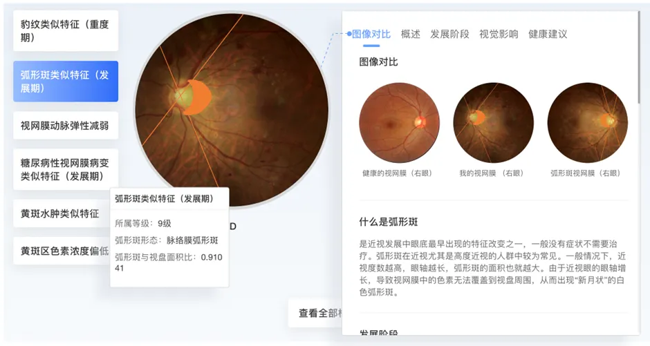 相机afc怎么调聚焦2100亿视光市场，新一代AI眼底相机AFC重磅上市_https://www.jmylbn.com_新闻资讯_第4张