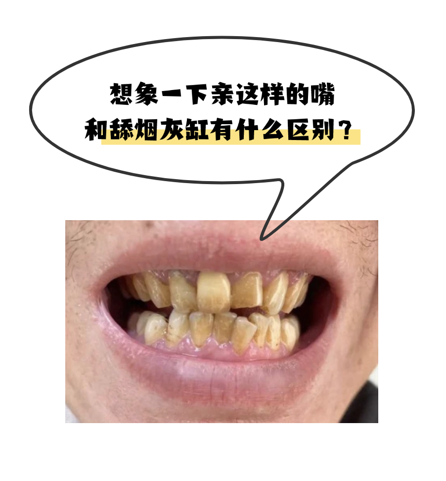 口臭的人为什么自己闻不到