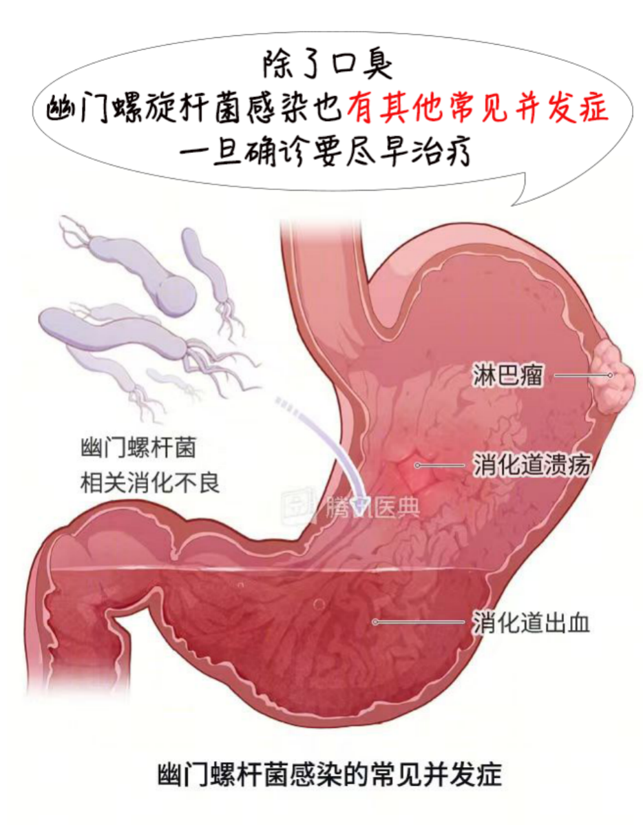 口臭的人为什么自己闻不到
